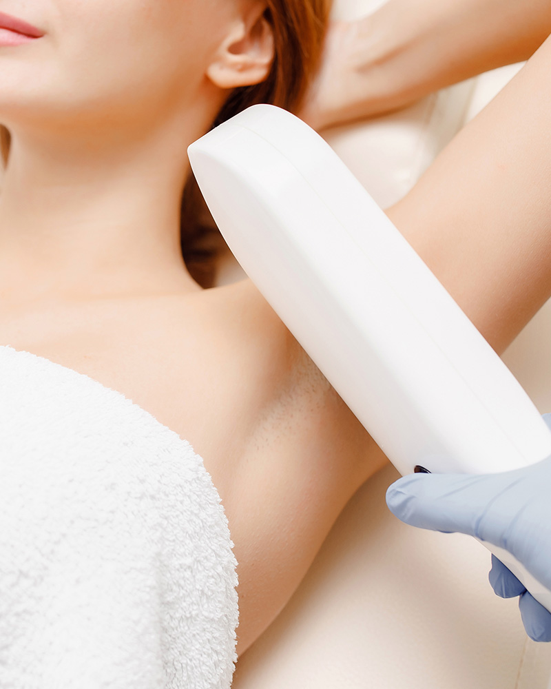 Laser hair removal